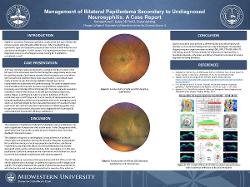 Management of Bilateral Papilledema Secondary to Undiagnosed Neurosyphilis: A Case Report