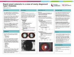 Rapid onset cataracts in a case of newly diagnosed Type I Diabetes