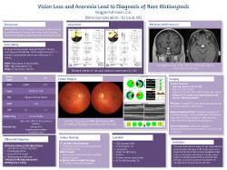 Acute vision loss leads to diagnosis of rare malignant histiocytosis